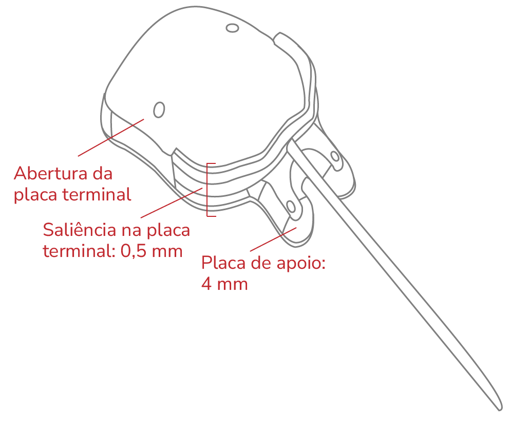 Implante de SUSANNA UF