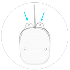 Implante de SUSANNA UF